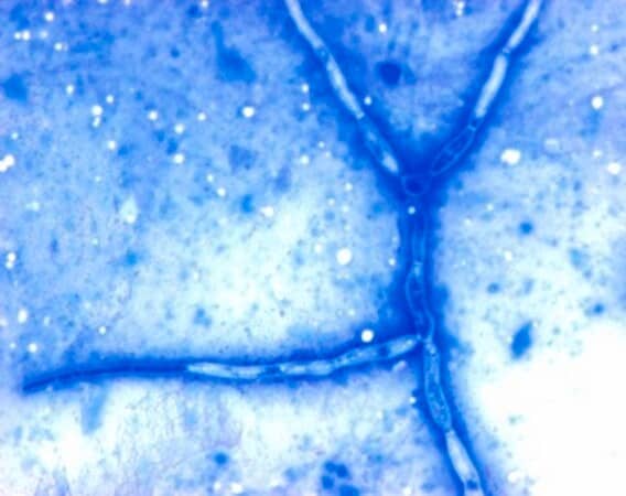 متیلن بلو مرک، کد 115943