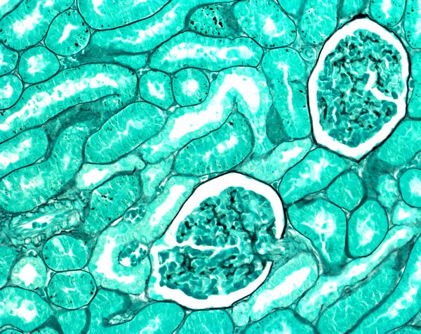 چسب انتلان مرک ، کد 107961